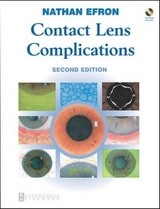 Contact Lens Complications - Efron, Nathan