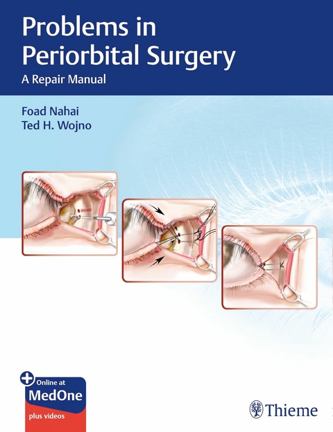 Problems in Periorbital Surgery -  Foad Nahai,  Ted H. Wojno