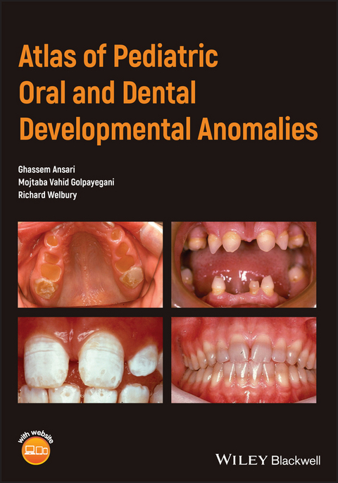 Atlas of Pediatric Oral and Dental Developmental Anomalies -  Ghassem Ansari,  Mojtaba Vahid Golpayegani,  Richard Welbury