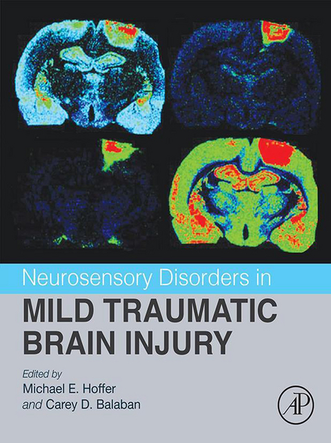 Neurosensory Disorders in Mild Traumatic Brain Injury - 