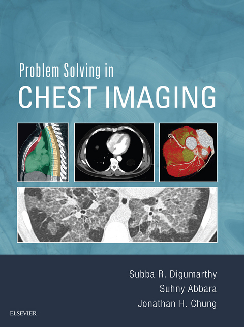 Problem Solving in Chest Imaging E-Book -  Subba R Digumarthy,  Suhny Abbara,  Jonathan Hero Chung