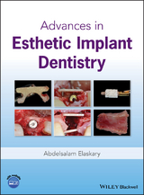 Advances in Esthetic Implant Dentistry -  Abdelsalam Elaskary