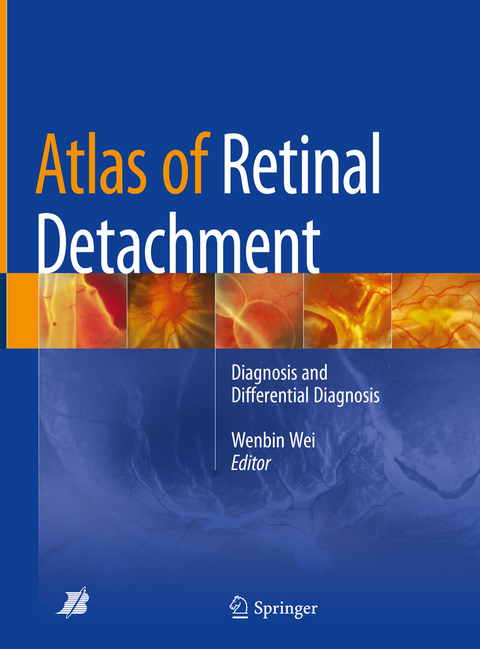 Atlas of Retinal Detachment - 