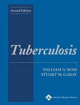 Tuberculosis - Rom, William N.; Garay, Stuart M.