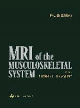 MRI of the Musculoskeletal System - Berquist, Thomas H.