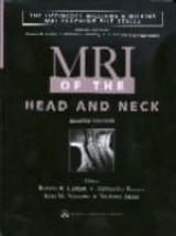 MRI of the Head and Neck - Lufkin, Robert B.; Borges, Alexandra; Nguyen, Kim N.; Anzai, Yoshimi