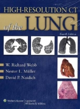 High-resolution CT of the Lung - Webb, W.Richard; Muller, Nestor Luiz; Naidich, David P.