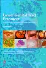 Lower Genital Tract Precancer - Singer, Albert; Monaghan, John M.; Chong, Quek Swee; Deery, Alastair R. S.