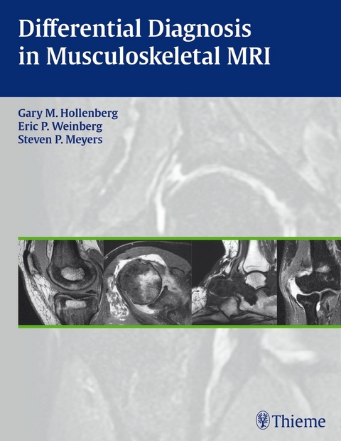 Differential Diagnosis in Musculoskeletal MRI - 