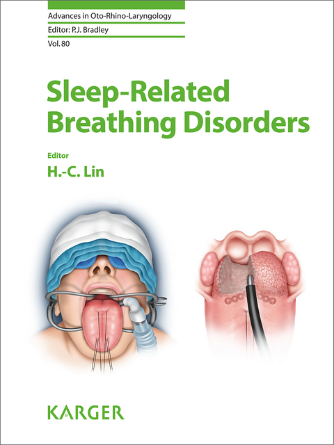 Sleep-Related Breathing Disorders - 