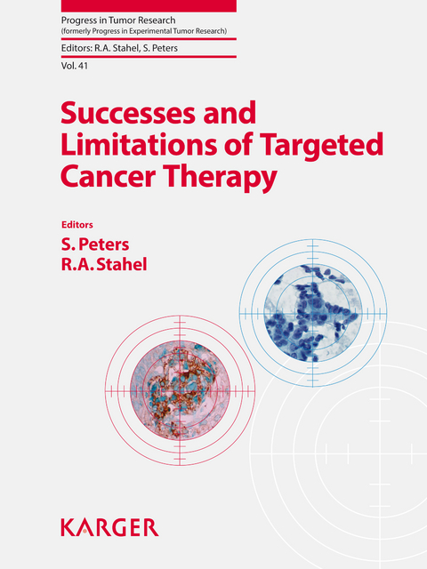 Successes and Limitations of Targeted Cancer Therapy - 