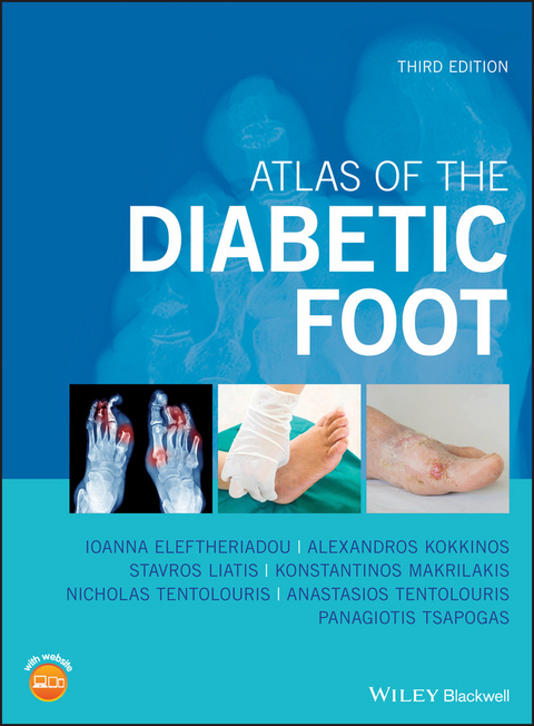 Atlas of the Diabetic Foot -  Ioanna Eleftheriadou,  Alexandros Kokkinos,  Stavros Liatis,  Konstantinos Makrilakis,  Anastasios Tentolouris,  Nicholas Tentolouris,  Panagiotis Tsapogas