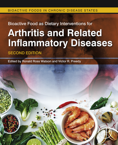 Bioactive Food as Dietary Interventions for Arthritis and Related Inflammatory Diseases - 