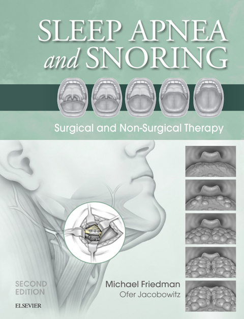 Sleep Apnea and Snoring - 