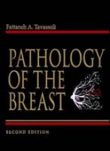 Pathology of The Breast - Tavassoli, Fattaneh