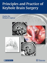 Principles and Practice of Keyhole Brain Surgery -  Charles Teo,  Michael E. Sughrue