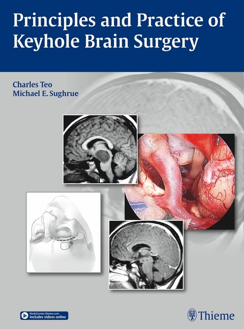 Principles and Practice of Keyhole Brain Surgery -  Charles Teo,  Michael E. Sughrue