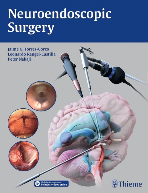 Neuroendoscopic Surgery - 