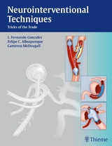Neurointerventional Techniques -  Fernando Gonzalez,  Felipe Albuquerque,  Cameron G. McDougall
