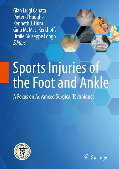 Sports Injuries of the Foot and Ankle - 
