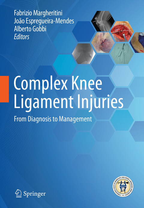 Complex Knee Ligament Injuries - 