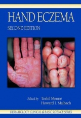 Hand Eczema - Menne, Torkil; Maibach, Howard I.