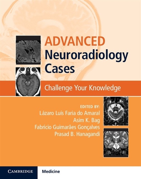Advanced Neuroradiology Cases - 
