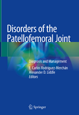 Disorders of the Patellofemoral Joint - 