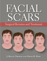 Facial Scars - 
