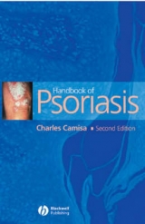 Handbook of Psoriasis - Camisa, Charles