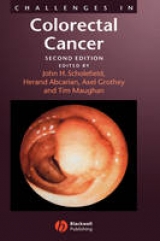 Challenges in Colorectal Cancer - Scholefield, John H.; Abcarian, Herand; Maughan, Tim; Grothey, Axel