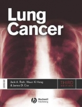 Lung Cancer - Roth, Jack A.; Cox, James D.; Hong, Waun Ki