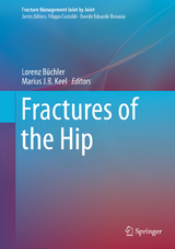 Fractures of the Hip - 