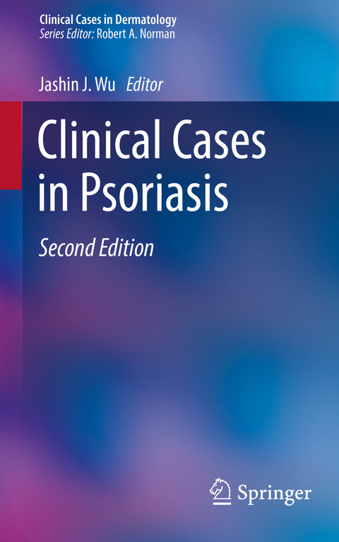Clinical Cases in Psoriasis - 
