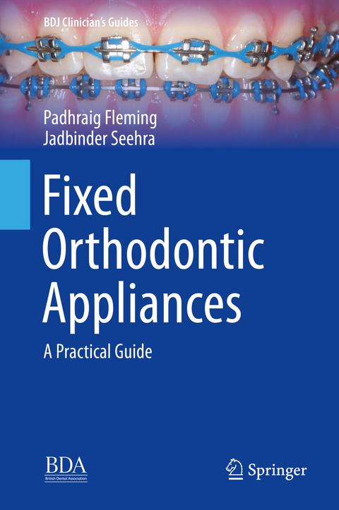 Fixed Orthodontic Appliances -  Padhraig Fleming,  Jadbinder Seehra