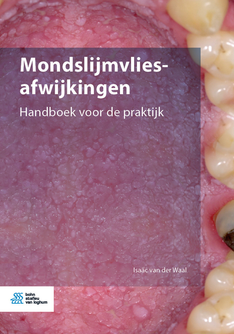 Mondslijmvliesafwijkingen - Isaäc van der Waal