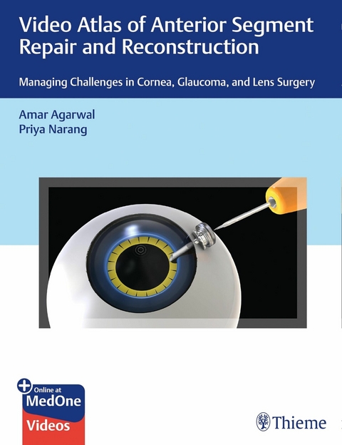 Video Atlas of Anterior Segment Repair and Reconstruction -  Amar Agarwal,  Priya Narang