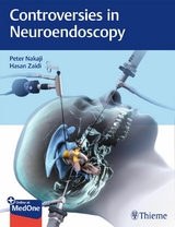 Controversies in Neuroendoscopy - Peter Nakaji, Hasan A. Zaidi