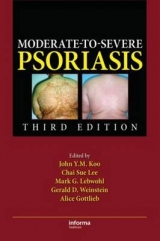 Moderate-to-Severe Psoriasis - Koo, John Y. M.; Lee, Chai Sue; Lebwohl, Mark G.; Levin, Ethan C.; Weinstein, Gerald