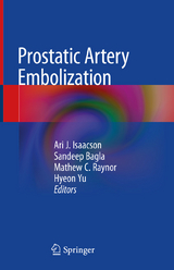 Prostatic Artery Embolization - 