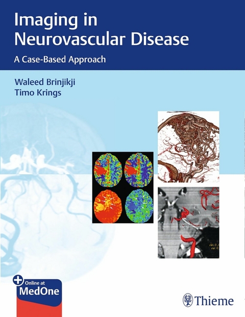 Imaging in Neurovascular Disease - Waleed Brinjikji, Timo Krings