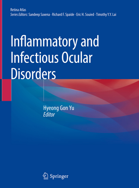Inflammatory and Infectious Ocular Disorders - 