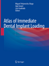 Atlas of Immediate Dental Implant Loading - 