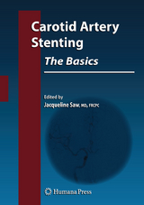 Carotid Artery Stenting: The Basics - 