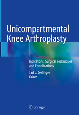 Unicompartmental Knee Arthroplasty - 