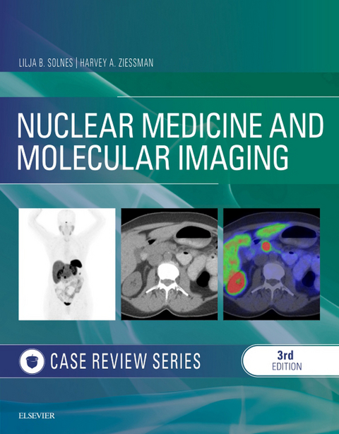 Nuclear Medicine and Molecular Imaging: Case Review Series E-Book -  Lilja B Solnes,  Harvey A. Ziessman