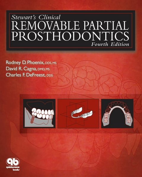 Stewart's Clinical Removable Partial Prosthodontics - Rodney D. Phoenix, David R. Cagna, Charles F. DeFreest