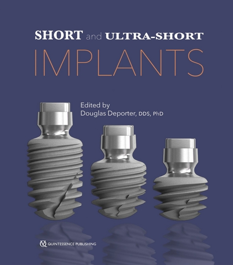 Short and Ultra-Short Implants -  Douglas Deporter