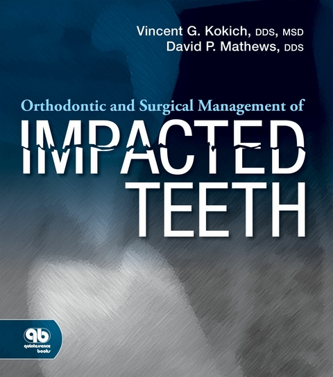Orthodontic and Surgical Management of Impacted Teeth - Vincent G. Kokich, David P. Mathews