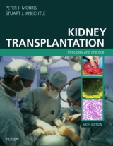 Kidney Transplantation - Morris, Peter J.; Knechtle, Stuart J.